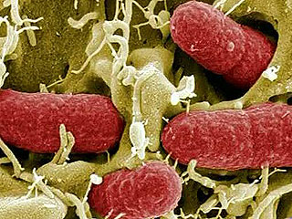 Ver vídeo 'La bacteria E.Coli, responsable de las muertes en Alemania'
