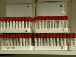Ver vídeo 'El laboratorio de referencia de la bacteria E. coli se encuentra en Lugo'