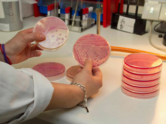 La OMS confirma que la bacteria E. coli se transmite de persona a persona