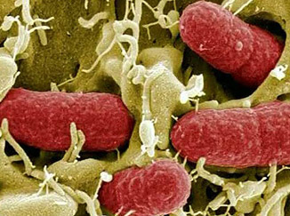 La variante peligrosa de E.coli no está en los pepinos que causaron la alerta